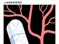 关于硝酸酯类药物（如硝酸异山梨酯）和双效片同服致命的信息