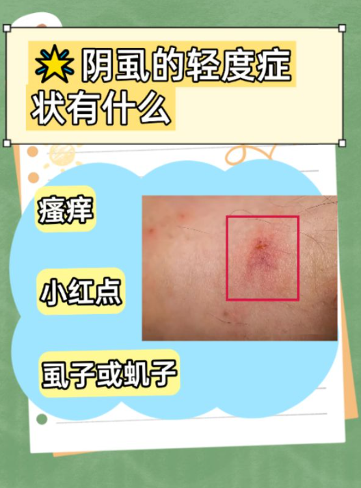印度双效片真实效果与副作用：过敏、皮疹、腹泻案例的简单介绍-第2张图片-印淘网