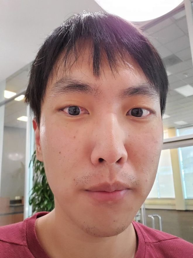 包含双效片副作用：视力模糊、蓝视症怎么办？的词条-第1张图片-印淘网